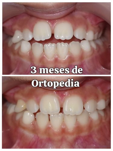 ortodoncia-mi-clinica-medica-6.jpeg